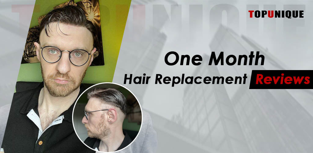 One Month TopUnique Hair Replacement Reviews