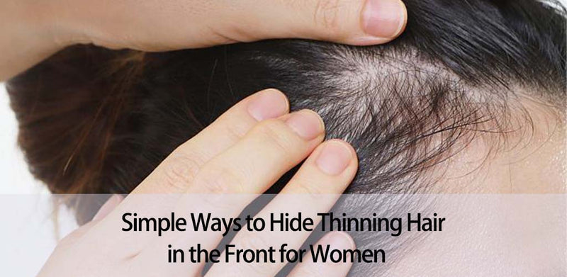 Simple Ways to Hide Thinning Hair in the Front for Women