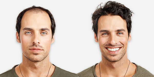 Why TopUnique Hair is Your Go-To Destination for Premium Hair Solutions?
