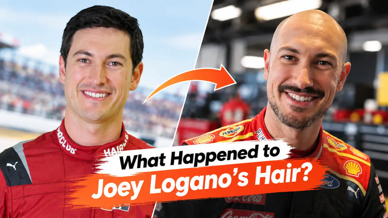 What Happened to Joey Logano's Hair? The Full Story