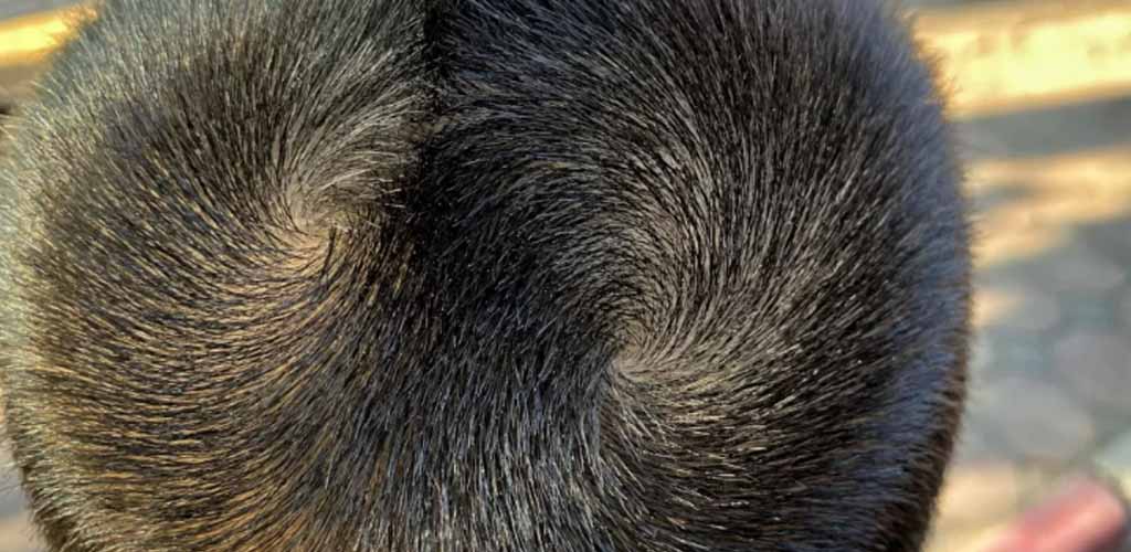 How to Fix Double Crown Hair: A Complete Guide to Natural Solutions