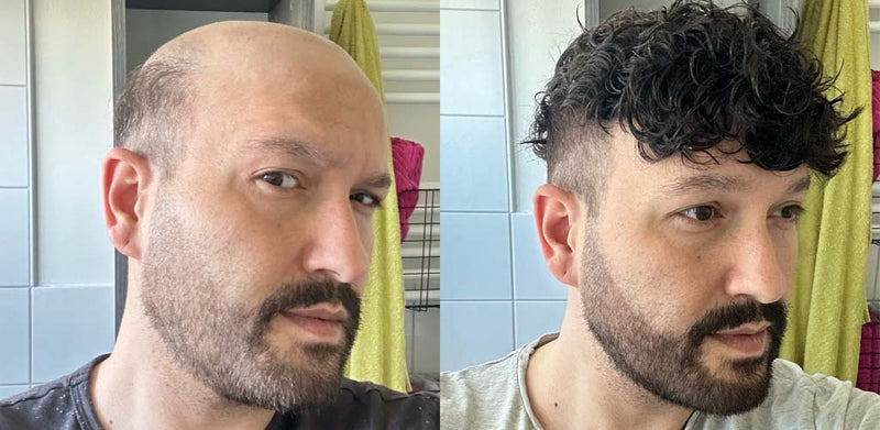 How to Care for Your Hair Replacement System: Cleaning, Installation, and Removal Explained