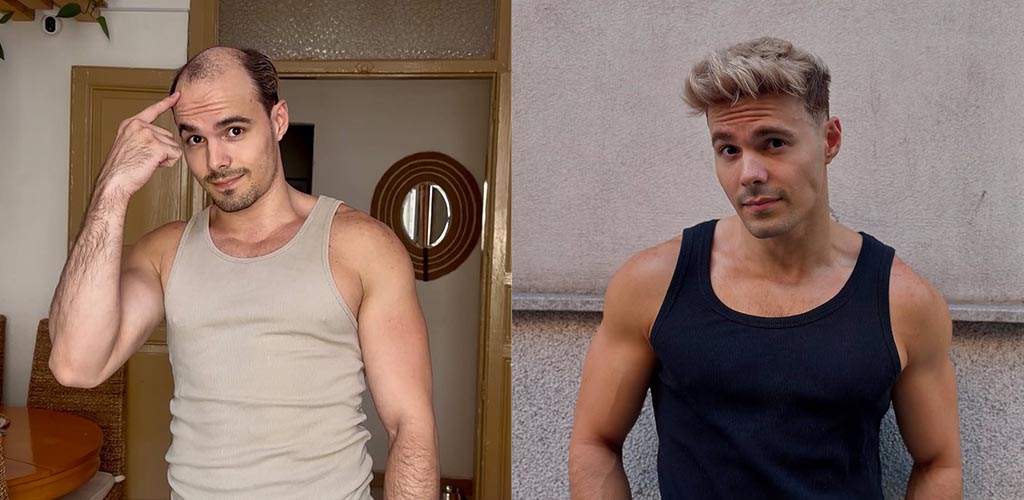 How Does a Toupee Work: A Step-by-Step Guide to Natural-Looking Hair