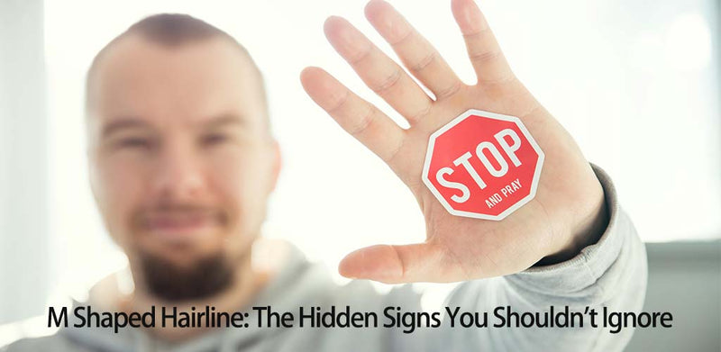 M Shaped Hairline: The Hidden Signs You Shouldn't Ignore