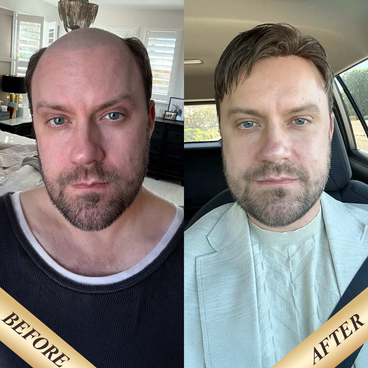 TopUnique TUL02 before and after