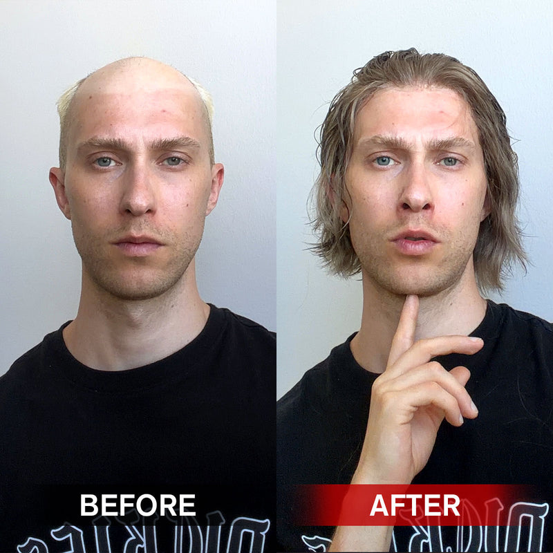 men_s_hair_system_4_babadae8-457e-45d2-8f63-2f436414a10e Customize A Full Lace or Lace + Skin Hybrid Hair System