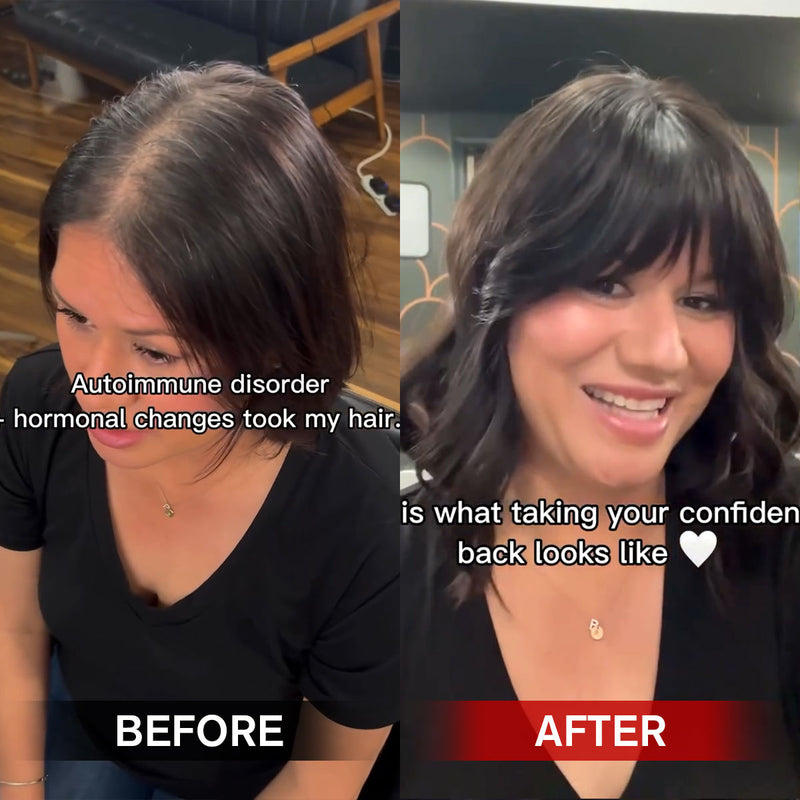 women_human_hair_topper_2_77b49271-6bfc-4932-89cb-bf35ed125c03 TUW28 Mono Topper with Weft | Women's Hair Replacement Systems