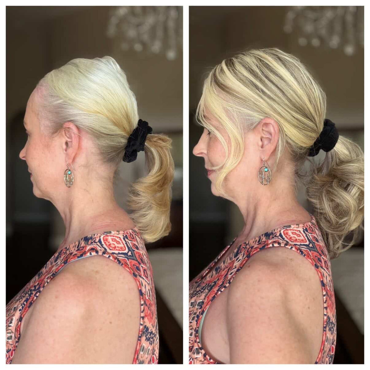 women_human_hair_topper_3 TUW16 Silk Base Hair Topper | Hair Topper for Thinning Crown